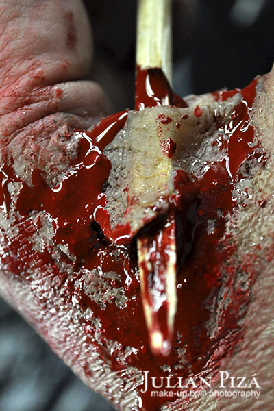 Un aparatoso accidente causa una herida sangrante en una mano